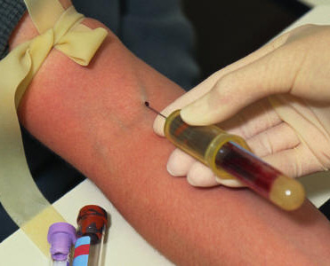 Анализ на креатинин